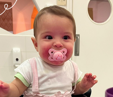 Baby with dummy in mouth and Eczema on face 