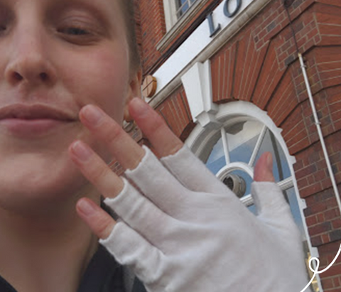 women with glove on hand covering eczema 