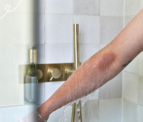 Man in the shower with eczema on his arm 