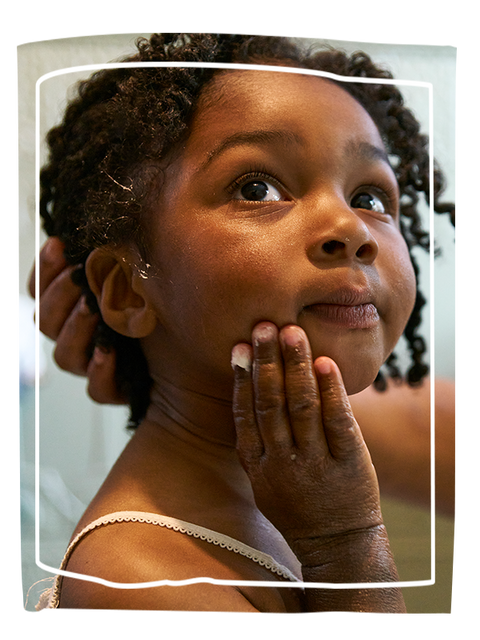 Girl with epaderm ointment on her face