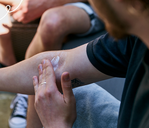 Man applying Epaderm to Eczema on arm