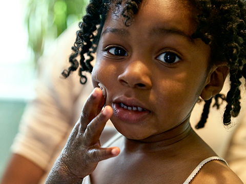 Girl with Epaderm Ointment on her face