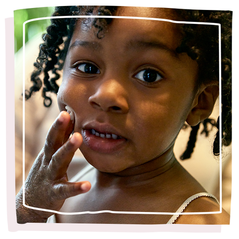 Girl with Epaderm Ointment on her face