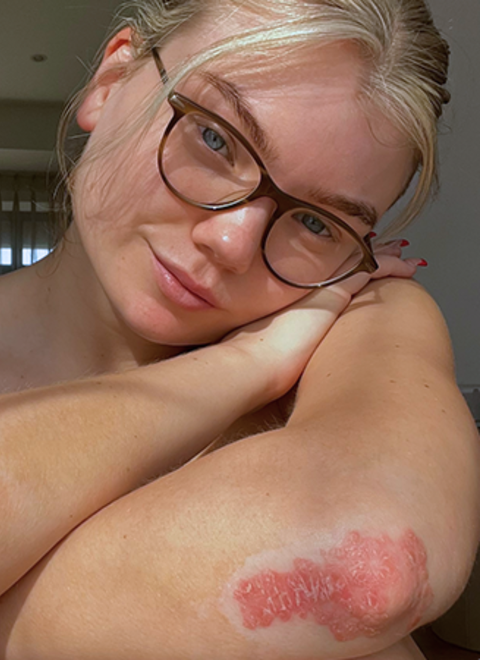 Skin Stories